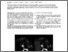 [thumbnail of Lowry_CombinedfMRI_2009.pdf]